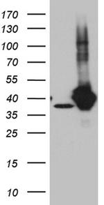 GIPC1 Antibody in Western Blot (WB)