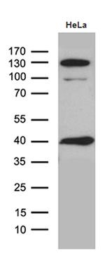 GIPC1 Antibody in Western Blot (WB)