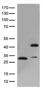 GIPC1 Antibody in Western Blot (WB)