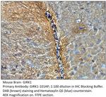 GIRK1 Polyclonal Antibody