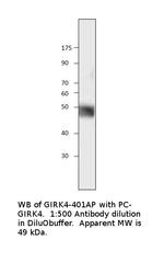 KCNJ5 Polyclonal Antibody