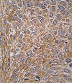 GIT1 Antibody in Immunohistochemistry (IHC)