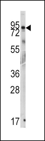 GIT1 Antibody in Western Blot (WB)