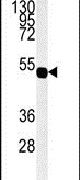 Connexin 45 Antibody in Western Blot (WB)