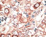 Connexin 26 Antibody in Immunohistochemistry (IHC)