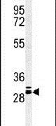 Connexin 26 Antibody in Western Blot (WB)