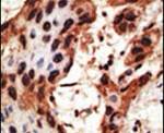 Connexin 30 Antibody in Immunohistochemistry (IHC)