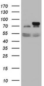 GLB1 Antibody in Western Blot (WB)