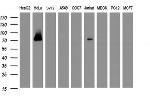 GLB1 Antibody in Western Blot (WB)