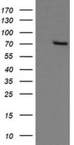 GLB1 Antibody in Western Blot (WB)