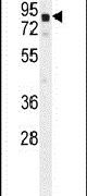 GLB1L2 Antibody in Western Blot (WB)
