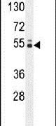 GLCCI1 Antibody in Western Blot (WB)