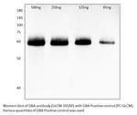 GBA Polyclonal Antibody