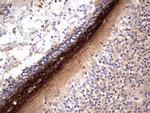 GLI1 Antibody in Immunohistochemistry (Paraffin) (IHC (P))