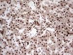 GLI1 Antibody in Immunohistochemistry (Paraffin) (IHC (P))
