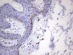 GLI1 Antibody in Immunohistochemistry (Paraffin) (IHC (P))