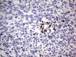 GLI1 Antibody in Immunohistochemistry (Paraffin) (IHC (P))