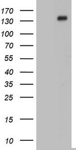GLI1 Antibody in Western Blot (WB)