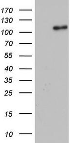 GLI1 Antibody in Western Blot (WB)