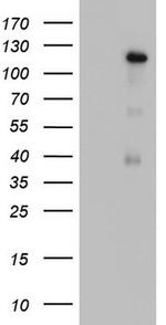 GLI1 Antibody in Western Blot (WB)