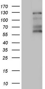 GLI1 Antibody in Western Blot (WB)