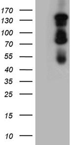 GLI1 Antibody in Western Blot (WB)