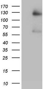 GLI1 Antibody in Western Blot (WB)