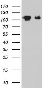 GLI1 Antibody in Western Blot (WB)