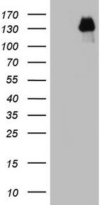 GLI1 Antibody in Western Blot (WB)