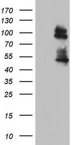GLI1 Antibody in Western Blot (WB)