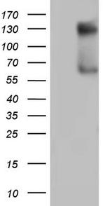 GLI1 Antibody in Western Blot (WB)