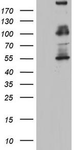GLI1 Antibody in Western Blot (WB)