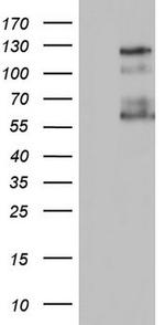 GLI1 Antibody in Western Blot (WB)