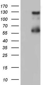 GLI1 Antibody in Western Blot (WB)
