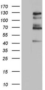 GLI1 Antibody in Western Blot (WB)