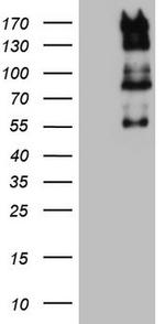 GLI1 Antibody in Western Blot (WB)