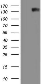 GLI1 Antibody in Western Blot (WB)