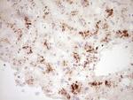 GLI4 Antibody in Immunohistochemistry (Paraffin) (IHC (P))