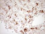 GLI4 Antibody in Immunohistochemistry (Paraffin) (IHC (P))