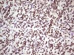 GLI4 Antibody in Immunohistochemistry (Paraffin) (IHC (P))