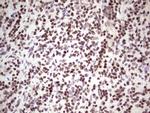 GLI4 Antibody in Immunohistochemistry (Paraffin) (IHC (P))