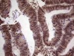 GLI4 Antibody in Immunohistochemistry (Paraffin) (IHC (P))