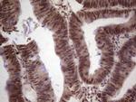 GLI4 Antibody in Immunohistochemistry (Paraffin) (IHC (P))