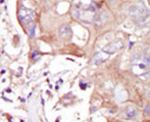 MAP4K3 Antibody in Immunohistochemistry (IHC)