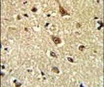 GLO1 Antibody in Immunohistochemistry (IHC)