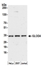 GLOD4 Polyclonal Antibody