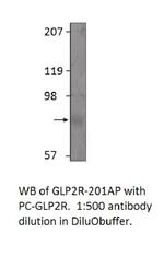 GLP2R Polyclonal Antibody