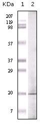 EHMT1 Monoclonal Antibody (1B7B4)