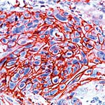 GLUT1 Antibody in Immunohistochemistry (IHC)
