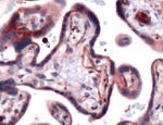 GLUT3 Antibody in Immunohistochemistry (IHC)
